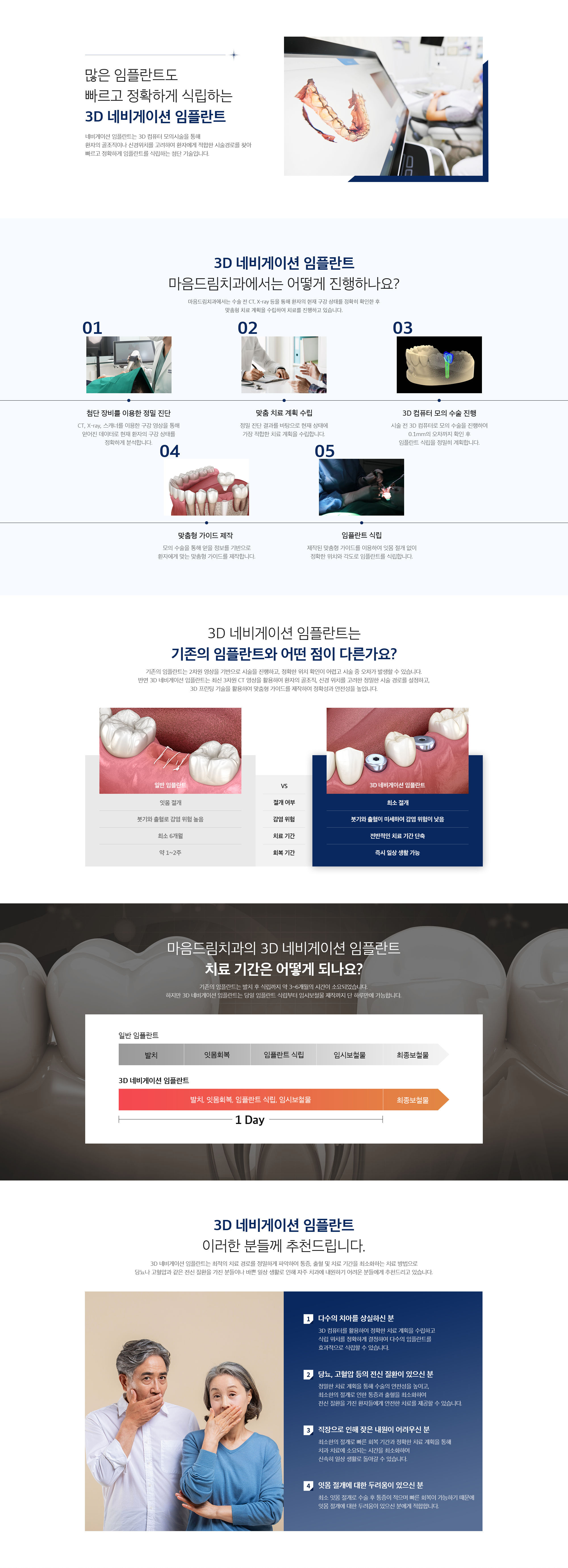 3D 네비게이션 임플란트
